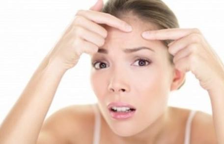 Plante care ajută tinerii să țină acneea sub control