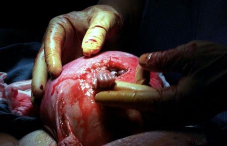 Fotografia care a emoționat întreaga lume