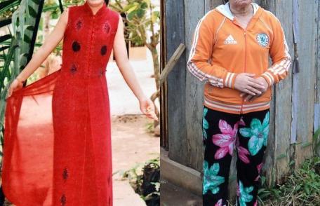 Caz bizar: O femeie de 23 de ani arată ca la 73 de ani