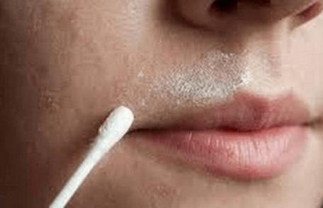 Tratament naturist pentru combaterea pilozitatii excesive