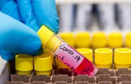 Statistică la nivel național: Peste 150 de cadre medicale și personal auxiliar confirmate cu COVID-19