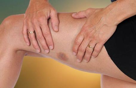 Semnele care anunță leucemia: care sunt persoanele cu risc