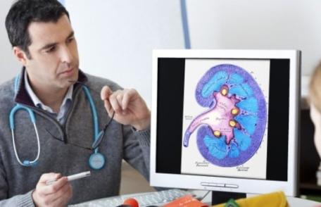 Cum se formează pietrele la rinichi