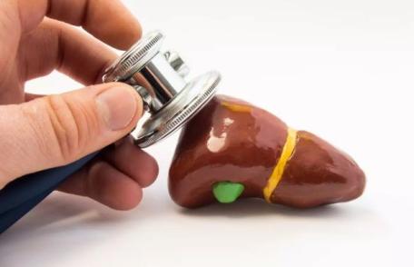 Boala ficatului gras. Descoperirea șocantă a doctorilor. Cum apare afecțiunea