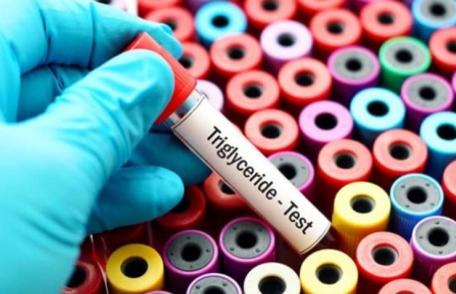 Trigliceridele în exces din sânge sunt extrem de periculoase. Ce efect au asupra organelor