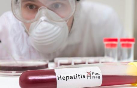 Cum se transmite hepatita C