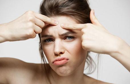 Plante care ajută tinerii să țină acneea sub control