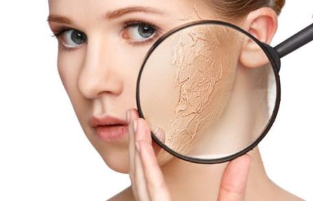 Ce trebuie să știe persoanele cu ten uscat