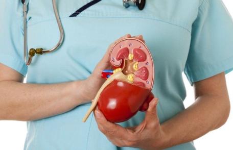 Cum se formează pietrele la rinichi