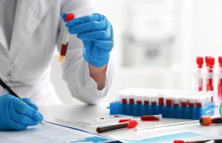 Cum să distingem colesterolul bun de cel rău