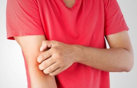 Te mănâncă pielea? Ce spune asta despre sănătatea ta mentală