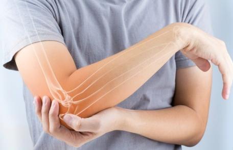 Ce trebuie să faci ca să previi osteoporoza