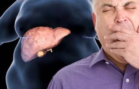 Semne care îți spun că ai un ficat toxic