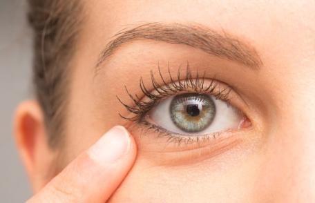 Cauze surprinzătoare care duc la apariția cearcănelor