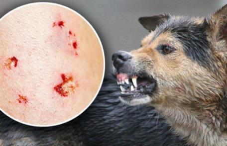 Ziua mondială de luptă împotriva rabiei. 13 focare descoperite în județul Botoșani