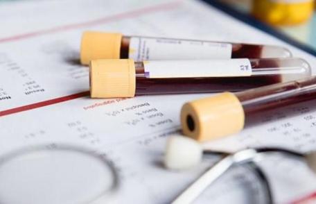 Analize gratuite. CNAS oferă servicii medicale gratuite pentru persoanele de peste 40 de ani