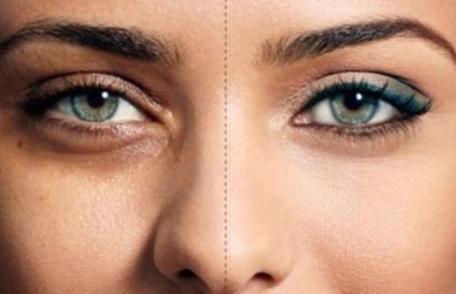 Aveți cercuri întunecate sub ochi? Ar trebui să scăpati de anumite obiceiuri