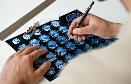 Semnele unui accident vascular cerebral