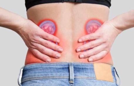 Ce este colica renală