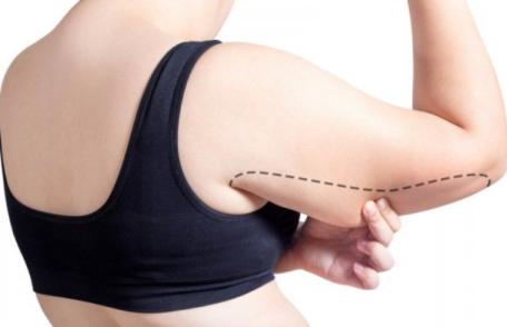 Aveți grăsime sub brațe care atârna? Iată ce puteți face!