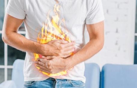Alimente benefice pentru reducerea arsurilor la stomac