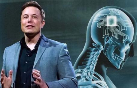 Compania lui Elon Musk a reușit să realizeze primul implant cerebral la om