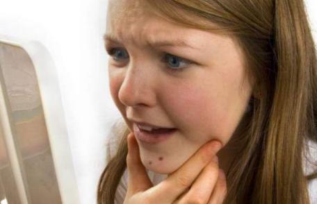 Învață cum să-ți îngrijești tenul dacă ai acnee