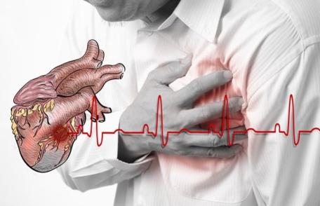 Ce să faci dacă ai un atac de cord și ești singur acasă