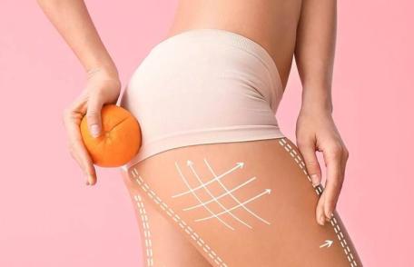 Primul pas în luptă cu celulita