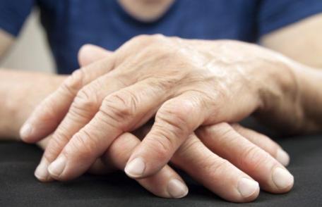 De ce apare artrita reumatoidă