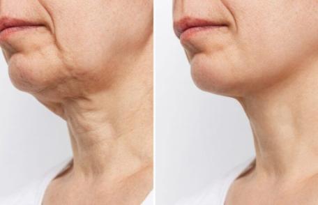 Cum poți evita îmbătrânirea prematură