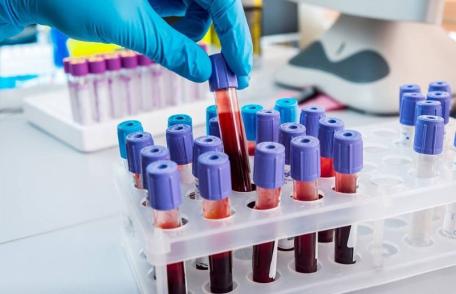 Laboratorul de Analize Medicale al Spitalului Dorohoi introduce analize noi realizate cu aparatură modernă și metode actuale
