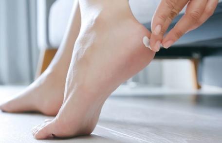 Tratamente naturiste eficace pentru călcâie crăpate: Picioare moi și sănătoase fără chimicale