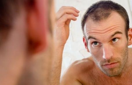 9 mituri despre căderea părului la bărbați
