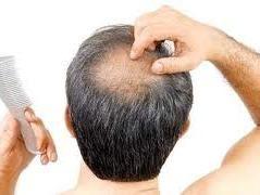 Ce sa mananci ca sa nu ramai fara par? 