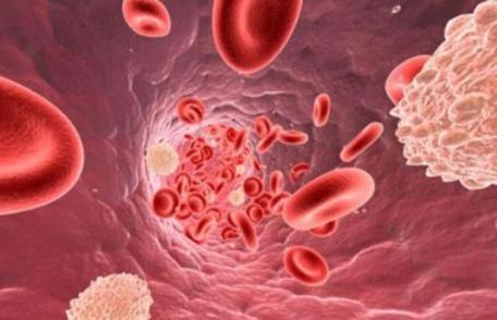 Ţii dietă dar ai colesterolul mărit? Iată unde greşeşti