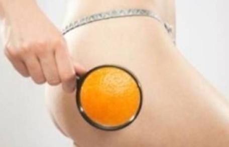 Cum poți scăpa de celulită!