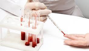 Descoperirea secolului. Un test de sânge ne va spune cât vom trăi