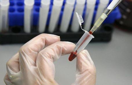 28 iulie Ziua Mondială de Luptă împotriva Hepatitei. Numărul bolnavilor cu hepatită C în creştere