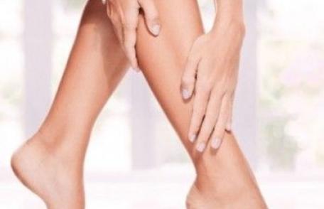 De ce apar varicele şi cum scăpăm de ele