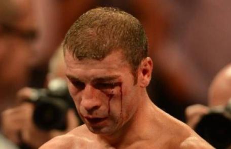 Diagnostic șocant pentru Lucian Bute: semipareză