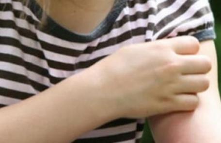 Sezonul insectelor. Ce boli transmit țânțarii și căpușele și cum le prevenim