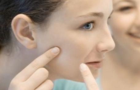 Trucuri pentru a scapa de acnee