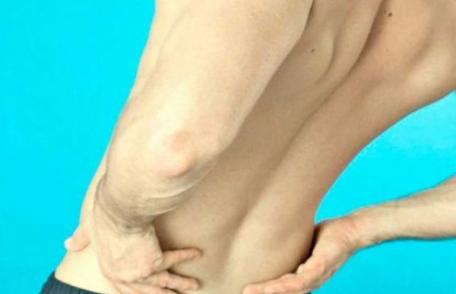 Cum îţi dai seama că ai pietre la rinichi