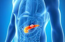 Cum prevenim cel mai ucigător tip de cancer, cel de pancreas