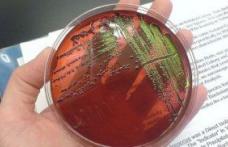Care sunt simptomele infectării cu E.coli şi cum ne putem proteja