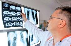  Cat sunt de nocive sunt radiografiile?