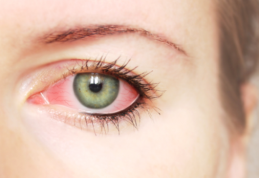 Ochiul roșu poate indica probleme grave de sănătate