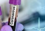 coronavirus-teste-1