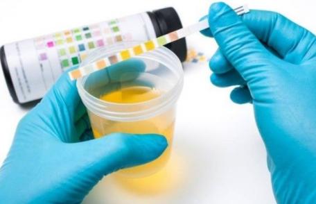 Cum să-ți testezi urina pentru a afla dacă ești sănătos